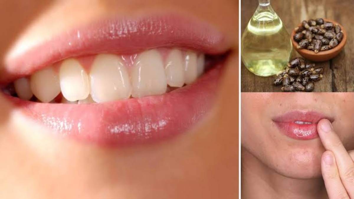 Castor Oil Benefits: होठों का कालापन करना चाहते हैं दूर तो अपनाएं एक छोटा सा उपाय